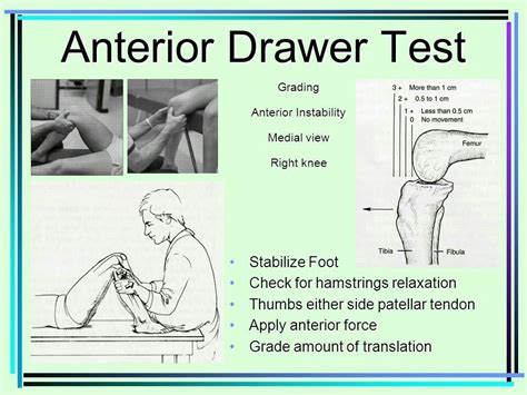 acl tear drawer test|positive drawer sign.